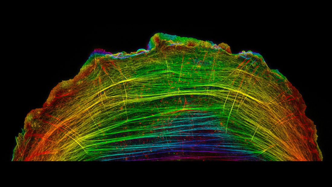 <strong>20th place: Dr. Dylan T. Burnette, Vanderbilt University School of Medicine</strong> <br /><br />A crawling bone cancer (osteosarcoma) cell showing actin filament bundles in the lamella