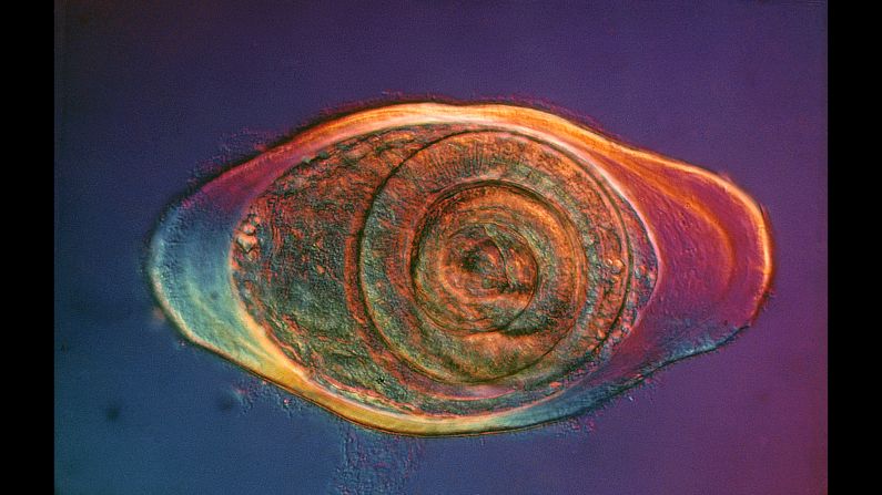 Encysted parasitic roundworm (trichinella spirals)