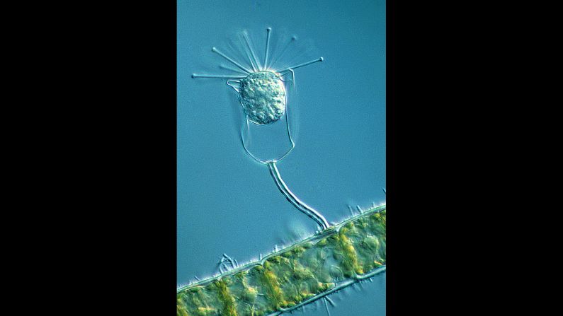 Stalked protozoan attached to a filamentous green algae with bacteria on its surface