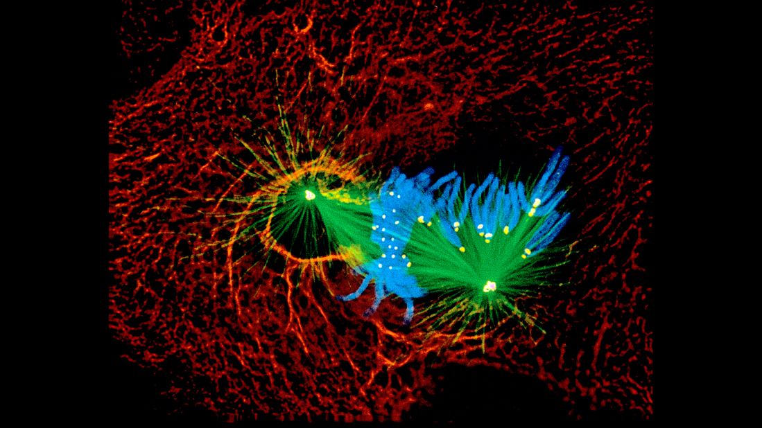 Newt lung cell in mitosis (five different structures)