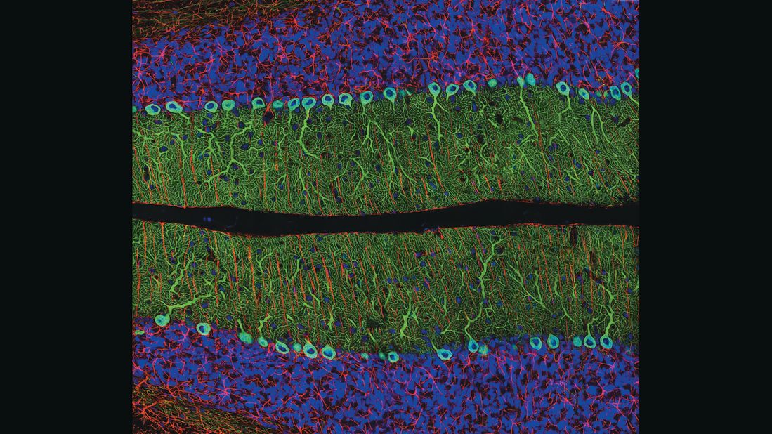 Thomas Deerinck won first prize with his<a href="http://www.nikonsmallworld.com/people/bio/thomas-deerinck" target="_blank" target="_blank"> first entry, a portion of a rat's brain,</a> in 2002. He's now one of the competition's most prolific winners, and in 2008 joined the judging panel. "Aesthetics is obviously a big part of the judging, but almost as important is the technical merit of the image and how difficult or rare it was to capture," Deerinck told CNN. Capturing microscopic images requires patience, steady hands and a "lot of preparation and persistence," he said. "One of the jobs of a scientist is to convey and communicate information in a concise and accurate manner, and it helps on occasion if it also happens to be beautiful science."