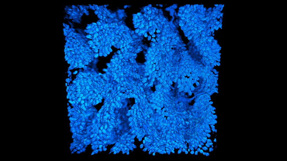 This detailed image is the cell nuclei of a mouse colon magnified 740 times. It was taken by Paul Appleton, a regular entrant to the competition who has contributed a <a href="http://www.nikonsmallworld.com/people/bio/paul-appleton" target="_blank" target="_blank">number of "Images of Distinction."</a>