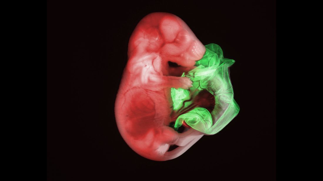 In 2007, first place went to this image of a double transgenic mouse embryo at 18.5 days. <a href="http://www.nikoninstruments.com/es_AMS/About-Nikon/News-Room/US-News/Nikon-Small-World-Entry-Deadline-Is-April-30th" target="_blank" target="_blank">Gloria Kwon,</a> a researcher at the Memorial Sloan Kettering Institute, used widefield microscopy and red and green fluorescence.