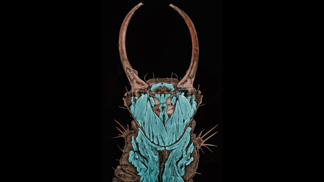 "My art causes a dissonance for its viewer -- a conflict between the culturally imprinted perception of an insect as something repulsive and ugly with a newly acquired admiration of the beauty of its form," said Dr. Igor Siwanowicz, referring to his winning image of a <a href="http://www.nikoninstruments.com/About-Nikon/News-Room/US-News/Tiny-Insect-Portrait-Captures-First-Place-in-2011-Nikon-Small-World-Competition" target="_blank" target="_blank">common green lacewing.</a> In real life, the bug's head was just 1.3 millimeters long, requiring great skill to dye and fix it in place for the shot.