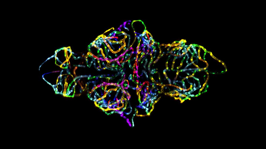 This winning image of a zebrafish embryo was injected with vibrant colors based on depth to convey spatial information, as well as to make it visually appealing. <a href="http://www.nikonsmallworld.com/galleries/entry/2012-photomicrography-competition/1" target="_blank" target="_blank">Dr. Jennifer L. Peters, one of the image's co-creators, said</a> the photo "not only captures the beauty of nature, but is topical and biomedically relevant."