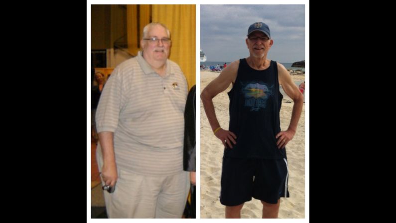 Jeff Baxter, a language arts teacher from Kansas City, Kansas, lost 270 pounds after undergoing gastric sleeve surgery.