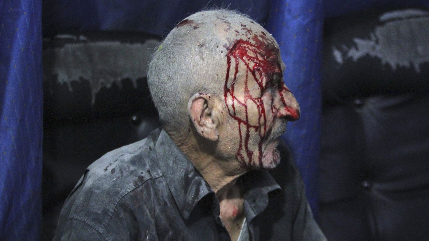 An injured man sits at a field hospital in Douma, Syria, on Friday, October 17, after what activists said were airstrikes carried out by forces loyal to Syrian President Bashar al-Assad. The United Nations estimates more than 190,000 people have been killed in Syria since an uprising in March 2011 <a href="http://www.cnn.com/2014/02/10/middleeast/gallery/syria-unrest-2014/index.html">spiraled into civil war.</a>