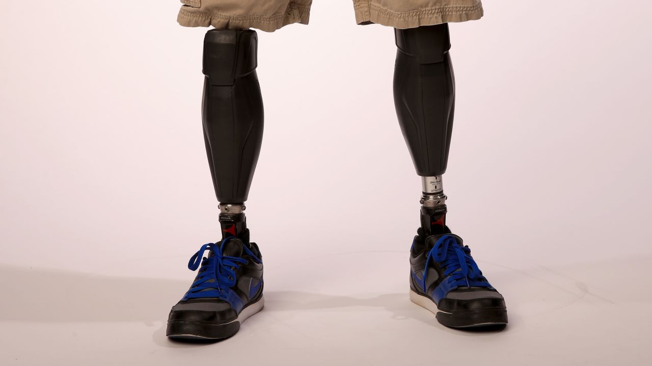 PARK CITY, UT - OCTOBER 01: Detail of the prosthetic legs of Alpine Skier Heath Calhoun as he poses for a portrait during the USOC Media Summit ahead of the Sochi 2014 Winter Olympics on October 1, 2013 in Park City, Utah. (Photo by Doug Pensinger/Getty Images)