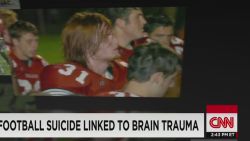 nr dnt ganim football players suicide brain trauma linked_00003401.jpg