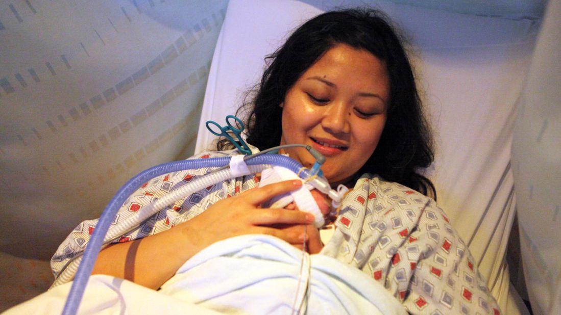 Julie Chung participates in a kangaroo care session, which means her son Ian lies -- tubes and all -- skin-to-skin on his mother's chest for at least an hour. In this photo, Ian is almost 7 weeks old, and weighs a little more than 2 pounds.