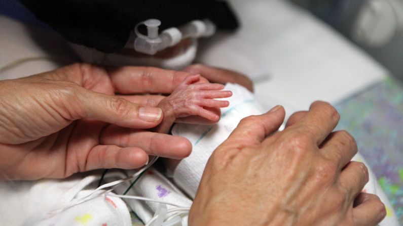 Los expertos dicen que menos del 1% de nacidos entran en la categoría de "bebé prematuro".