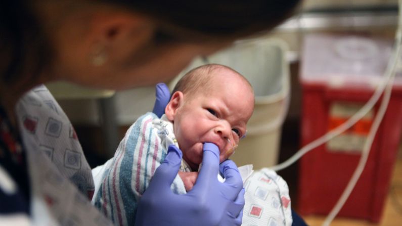 Algunos elementos de lo que se realiza en el Hospital Infantil, incluidas varias formas de terapia de tacto, pueden ser benéficos a los bebés prematuros.