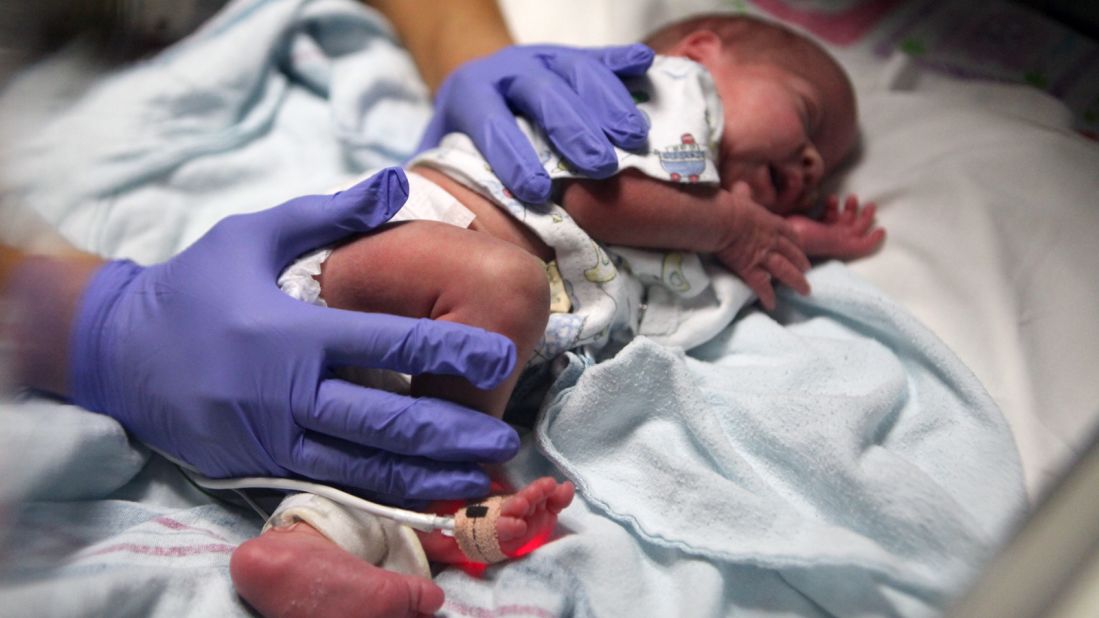 Doctors at Children's Hospital of Orange County also believe touch is crucial to these newborns' development. 