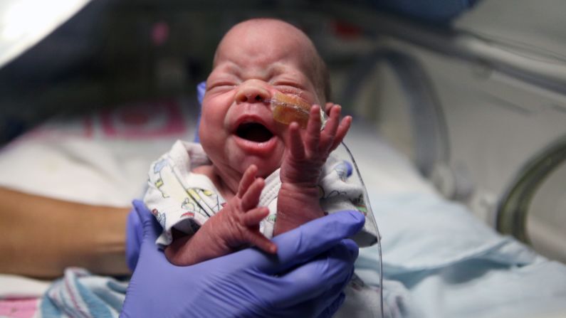 Staff at the hospital say the Small Baby Unit's focus on lighting, sound and touch has reduced disability and infection rates for these preemies. Persephone Contreras is now almost 4 pounds, 11.5 ounces.