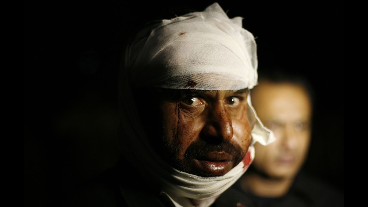 A Pakistani man wounded in a suicide bomb attack receives first aid at a hospital near Lahore on Sunday, November 2. At least 60 people were killed Sunday in a suicide attack on the Pakistani-Indian border, police said.