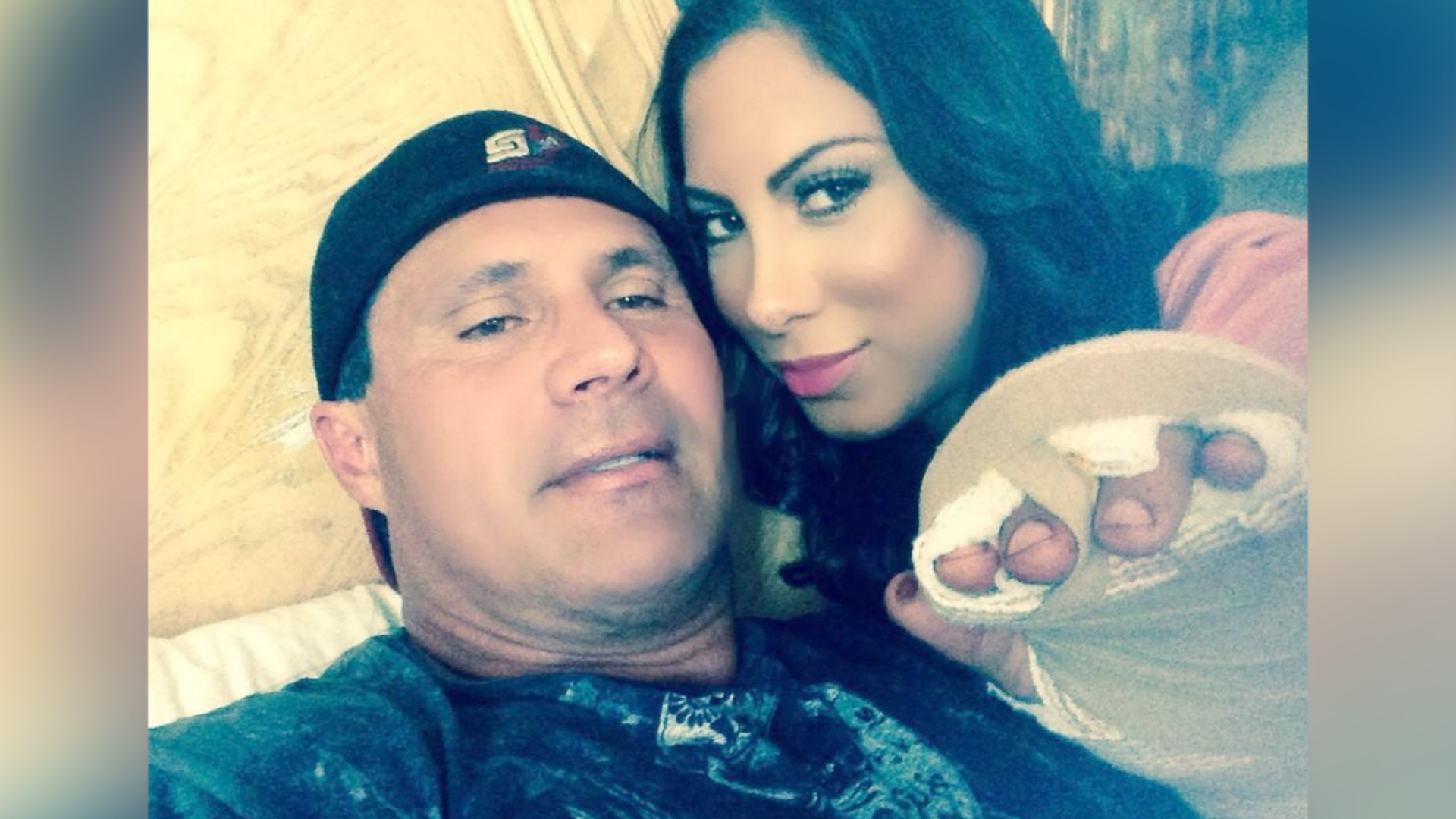 Jose Canseco's finger fell off during a poker tournament 