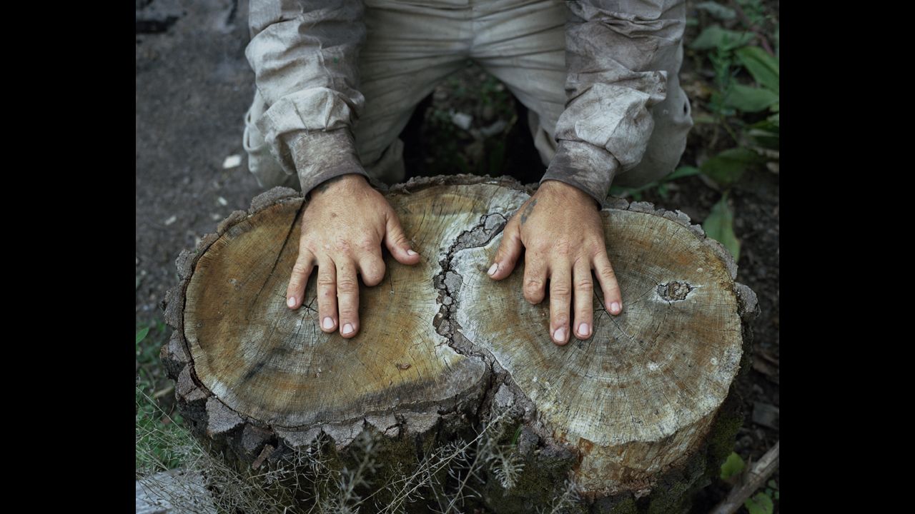 A hermit's hands show two missing fingers. 
