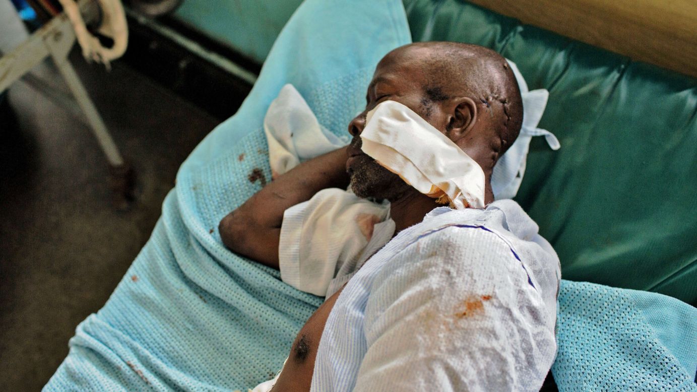 A man recovers at a hospital in Mombasa, Kenya, on Tuesday, November 18, after he was attacked by machete-wielding youth in the country's Kisauni area. Youths took to the streets in apparent revenge attacks after two mosques were raided for alleged links to Al-Shabaab militants.