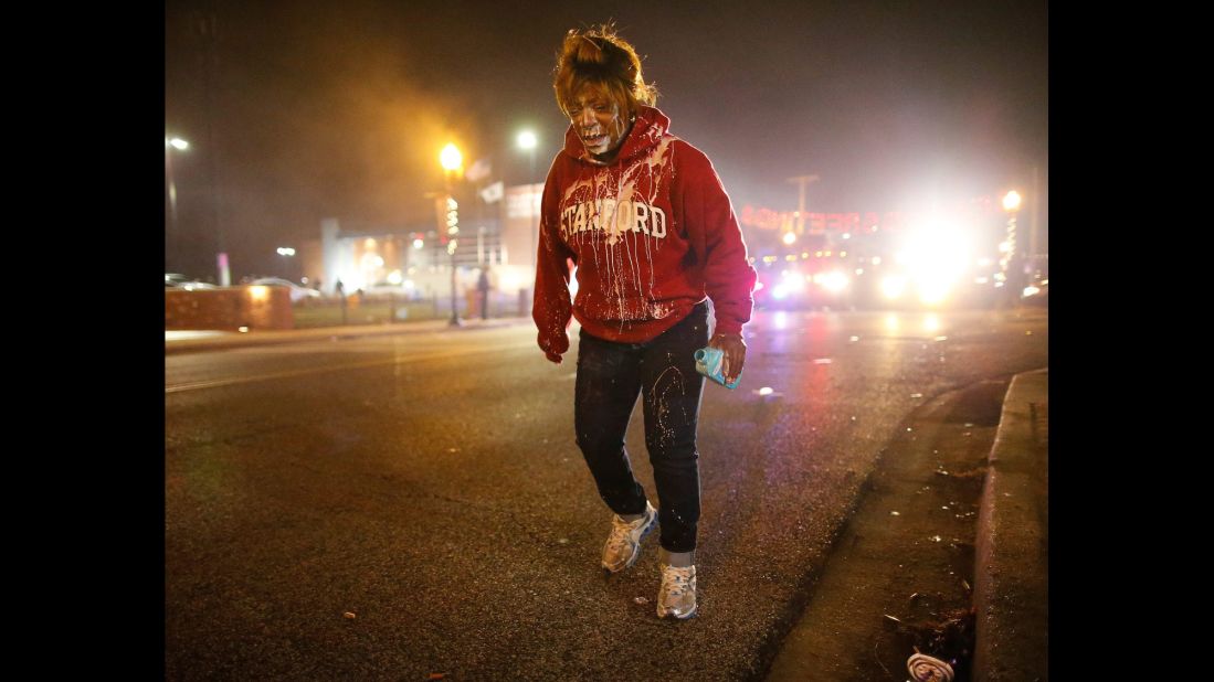 A woman treats her face for possible tear gas exposure on November 24.