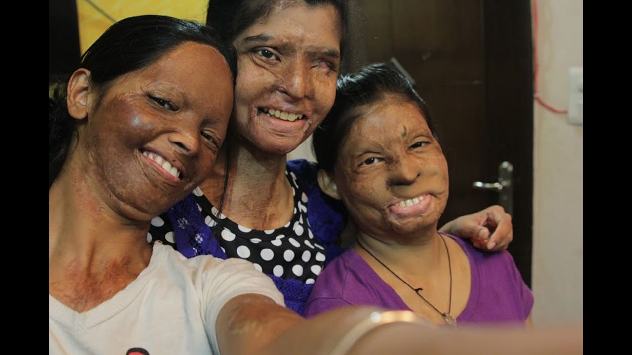 Three acid attack victims, Laxmi, Rupa and Ritu, take a selfie Friday, June 20, for the <a href="https://www.facebook.com/photo.php?fbid=166427150199113&set=a" target="_blank" target="_blank">Stop Acid Attacks campaign:</a> "Together we can eliminate this social evil. ... Help us succeed in our fight to end #AcidViolence in India."