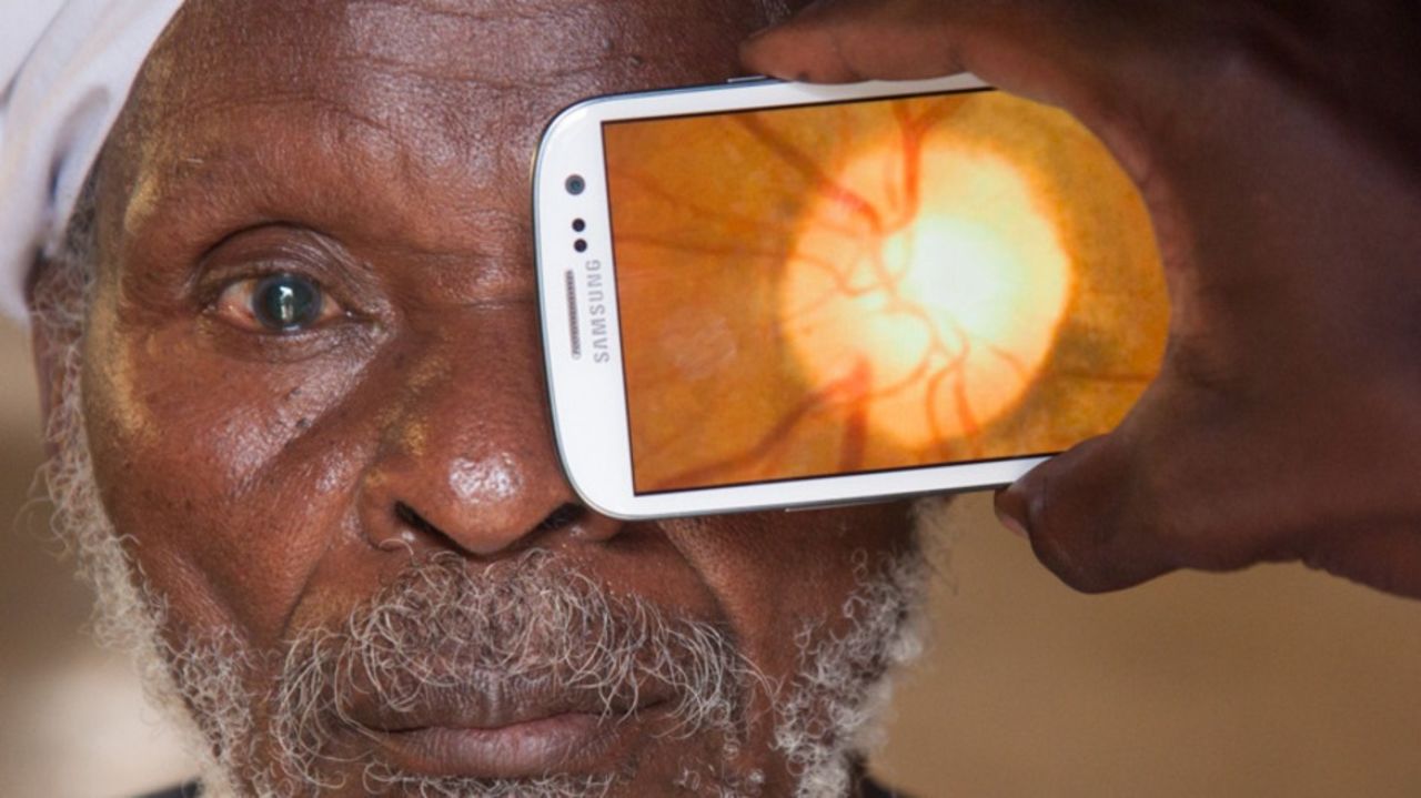 The Portable Eye Examination Kit (Peek) app allows healthcare professionals to conduct eye examinations using a smartphone app. It has already been tested on thousands of people in rural Kenya. There are 39 million blind people globally, and in low-income countries, 80% of blindness is curable.<br />