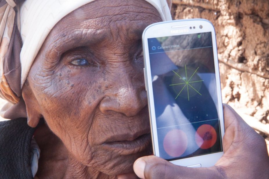 Testing for cataracts outside a patient's home.