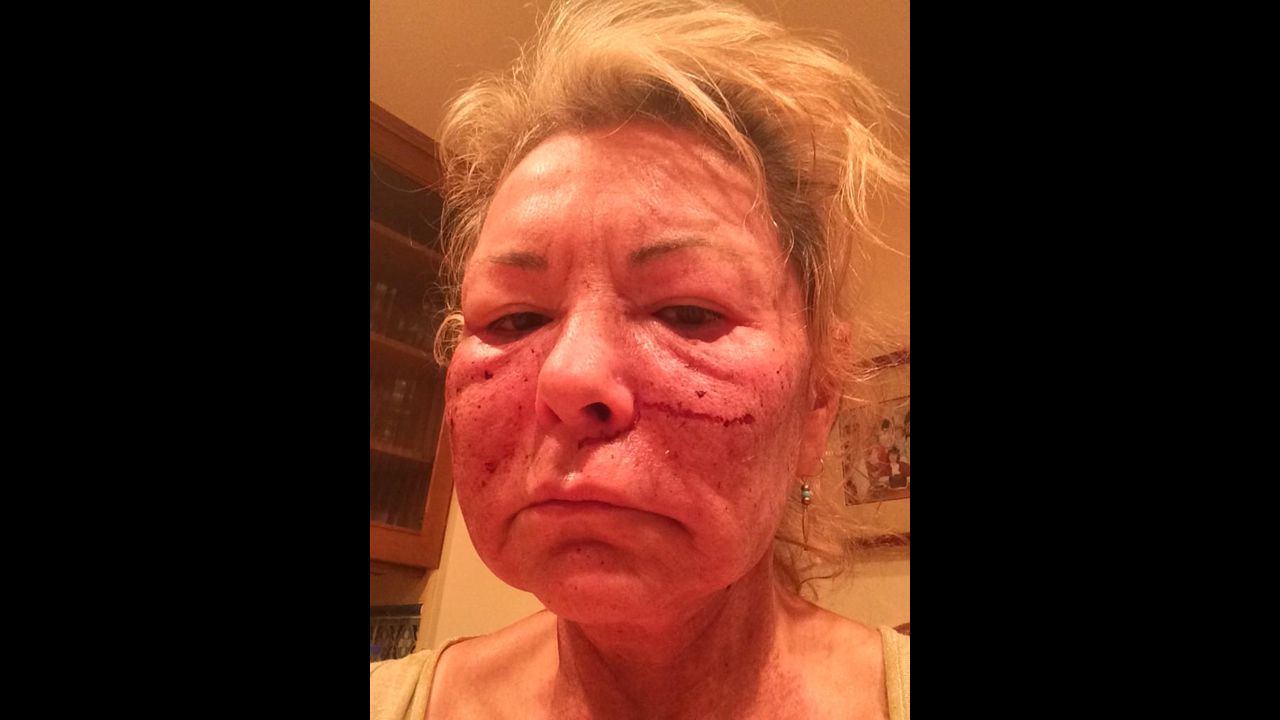 "Got a chemical peel to look more sexier," <a href="https://twitter.com/therealroseanne/status/537510206062612480" target="_blank" target="_blank">tweeted</a> comedian Roseanne Barr on Tuesday, November 25. "Joked about tussling Cosby."