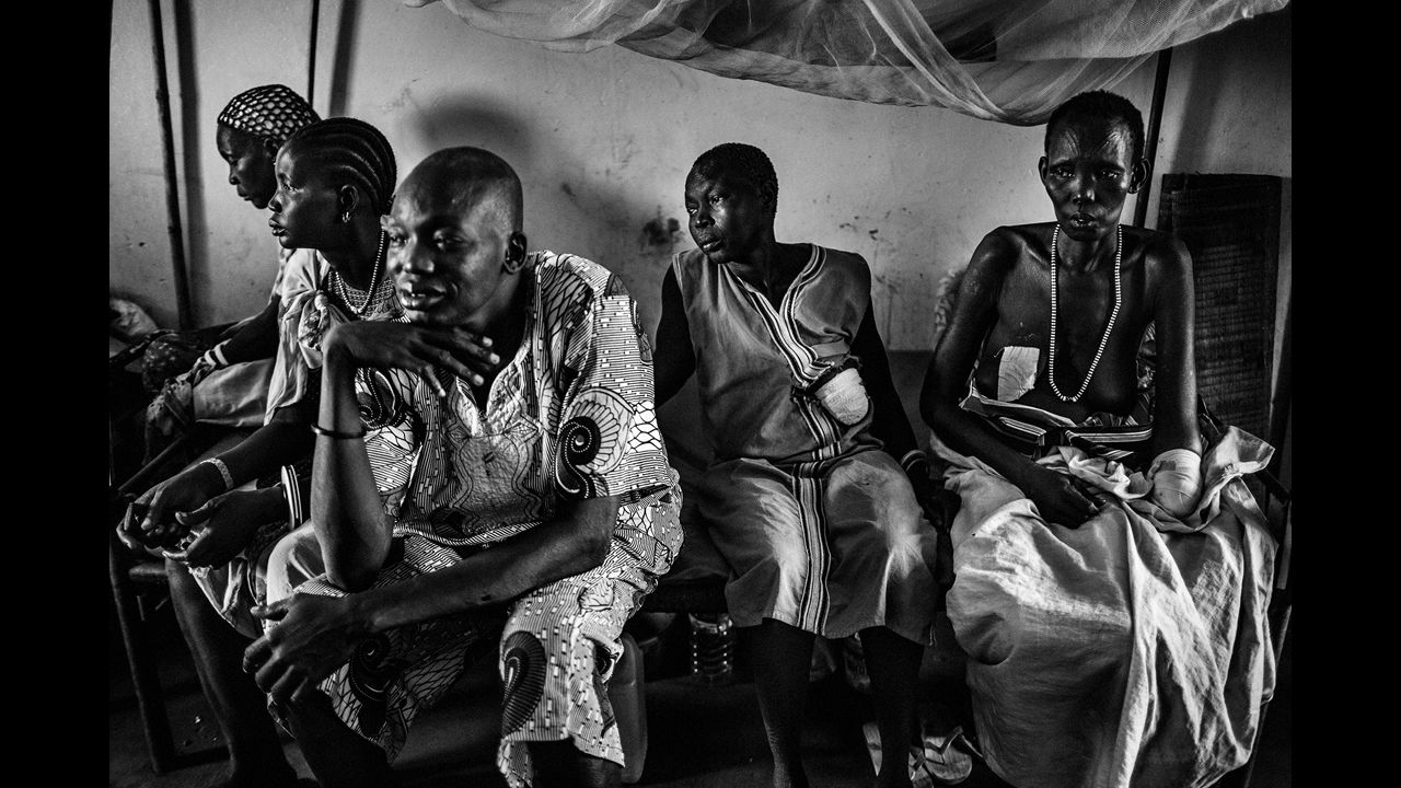 South Sudanese civilians wait at a government hospital in Yirol. These women have all sorts of wounds, including lost limbs and injuries to their breasts.