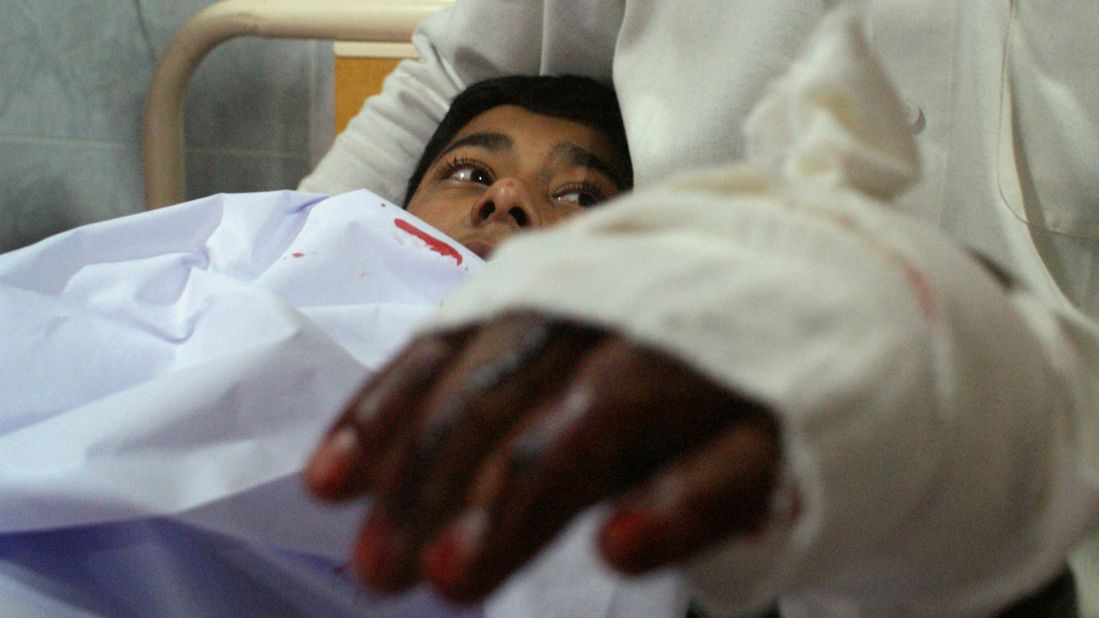 An injured student lies in bed at a Peshawar hospital after the attack.