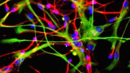 neurons made from neural stem cells