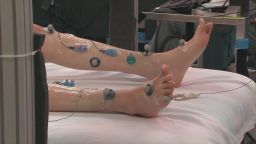 A paralyzed Goza moves his legs after doctors increase the voltage in sensors attached to his legs.