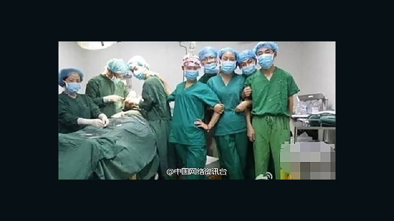 Doctors are pictured linking arms with each other in the operating theater.