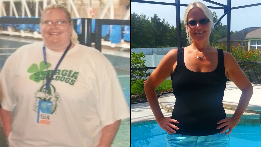 <a href="http://www.cnn.com/2014/09/22/health/weight-loss-jen-corn-irpt/">Jen Corn</a>'s family offered to pay for weight-loss surgery, but she decided to change her lifestyle on her own. She joined Weight Watchers and has lost more than 150 pounds since 2011. She walks five miles a day and is signed up to walk her first half-marathon this year. 