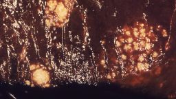 <em>Candida albicans</em> infecta un hígado humano. La candidiasis invasiva se produce cuando las especies de <em>Candida</em> entran en el torrente sanguíneo y se propagan por todo el cuerpo.