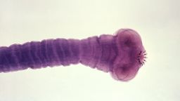 A  cysticercus of Taenia solium. Taeniasis, the intestinal infection transmitted by the worm is a mild condition, but it plays a crucial role in a patient developing cysticercosis, a serious disease caused by tape worm larvae. 