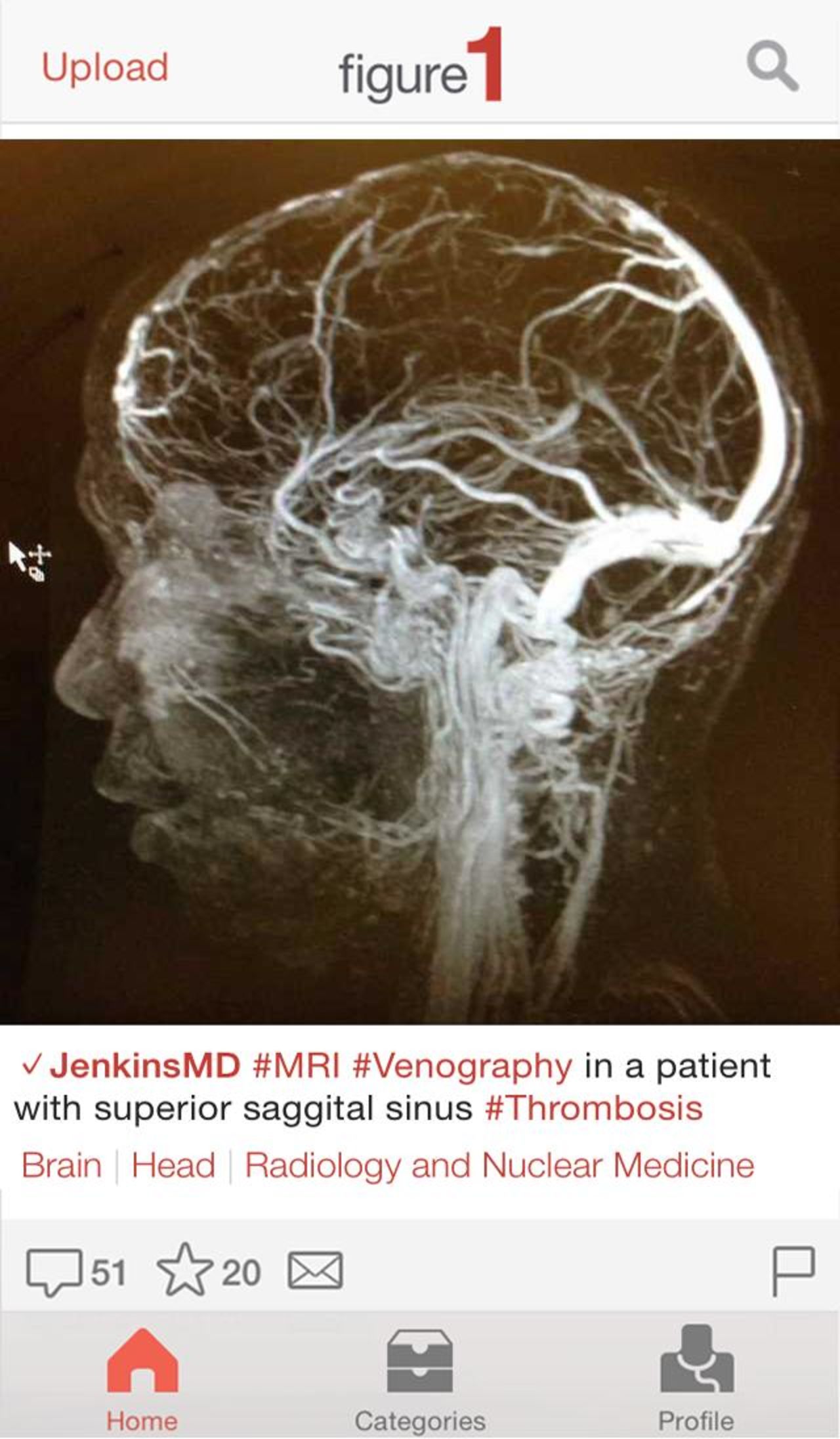 When users upload an image, any identifying information is removed before the image is posted. Here, an X-ray of a patient's veins, known as a venogram, is uploaded for consultation.