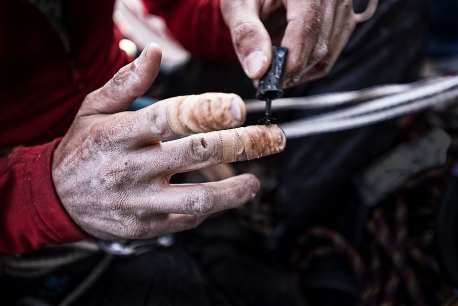 A close-up of Jorgeson's hands on Saturday, January 10.
