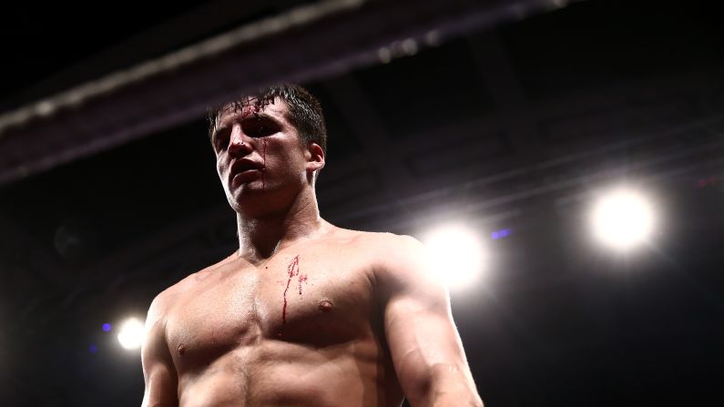 A cut on Anthony Fowler caused his middleweight bout to be stopped prematurely during the World Series of Boxing on Thursday, January 15. But Fowler still won on points, helping the British Lionhearts defeat the China Dragons 3-2 in London.