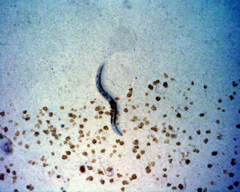 C. elegans worms were aboard the Space Shuttle Columbia when it broke up upon reentry on February 1, 2003. The worms were found alive in a container that was among the debris.