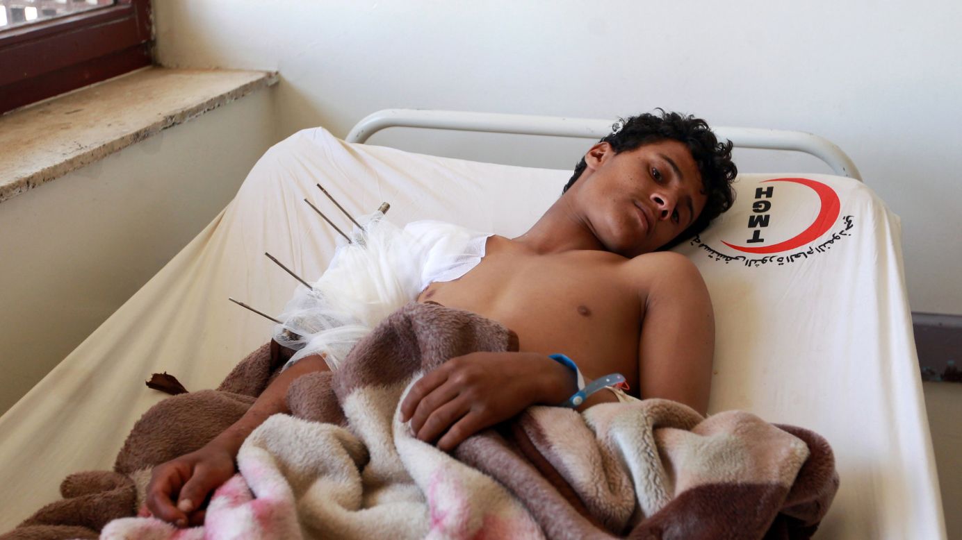 A wounded man rests at a hospital in Sanaa on January 21. He was reportedly injured in fierce clashes the previous day.
