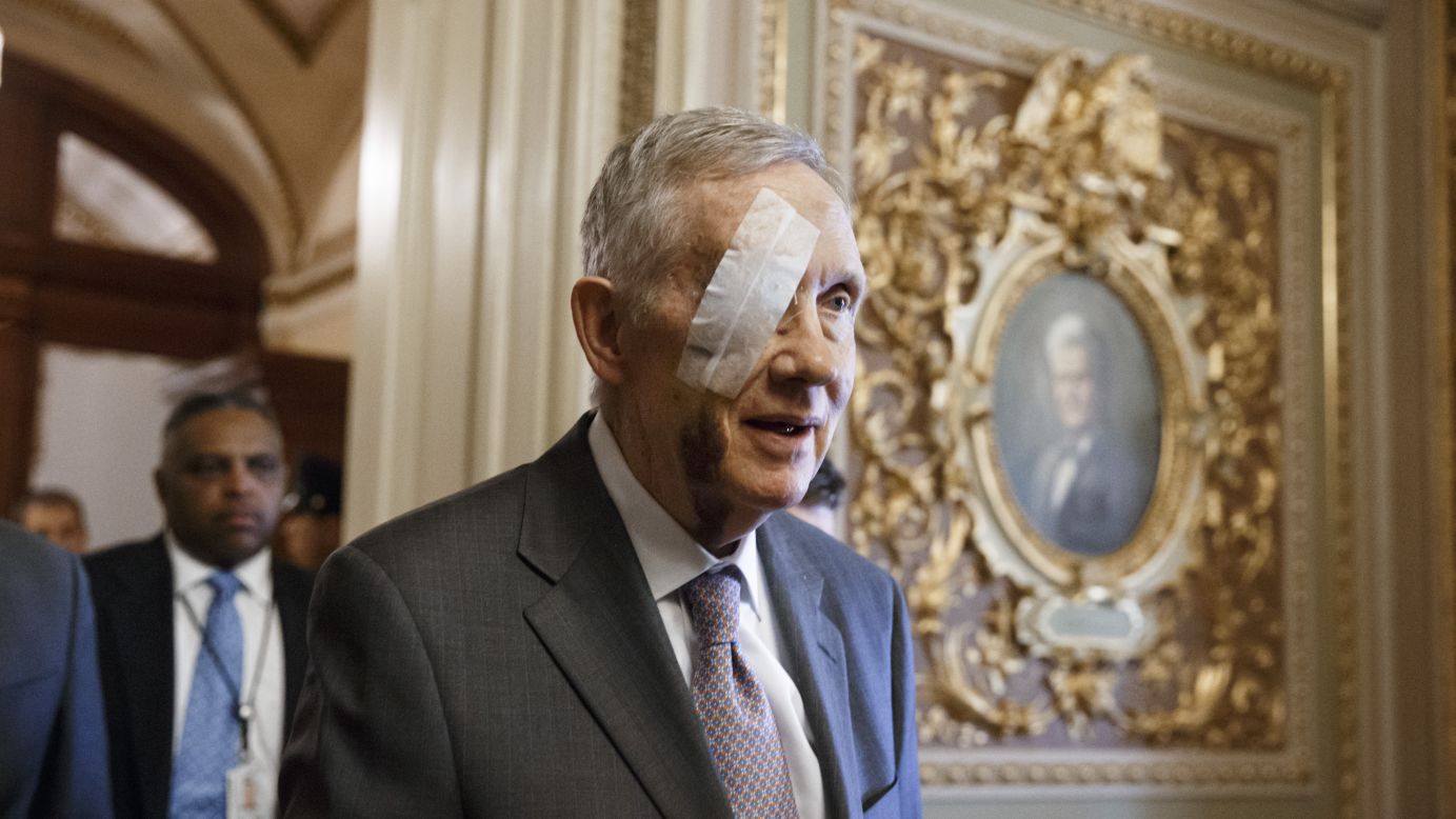 Senate Minority Leader Harry Reid has his eye patched up as he returns to Capitol Hill in Washington on Tuesday, January 20. Reid hurt his eye a few weeks ago while exercising at his home in Nevada. He will have surgery to help him recover his full vision.