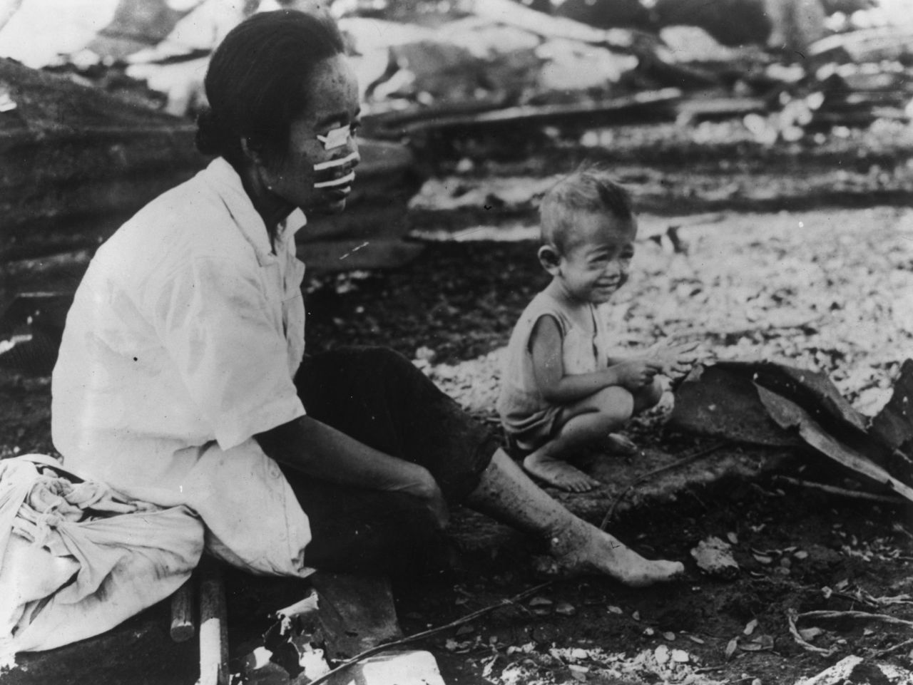 A Filipina woman wounded in the face by shrapnel waits in front of her burnt home in Manila in March 1945. An estimated million Filipino civilians died during World War II.  