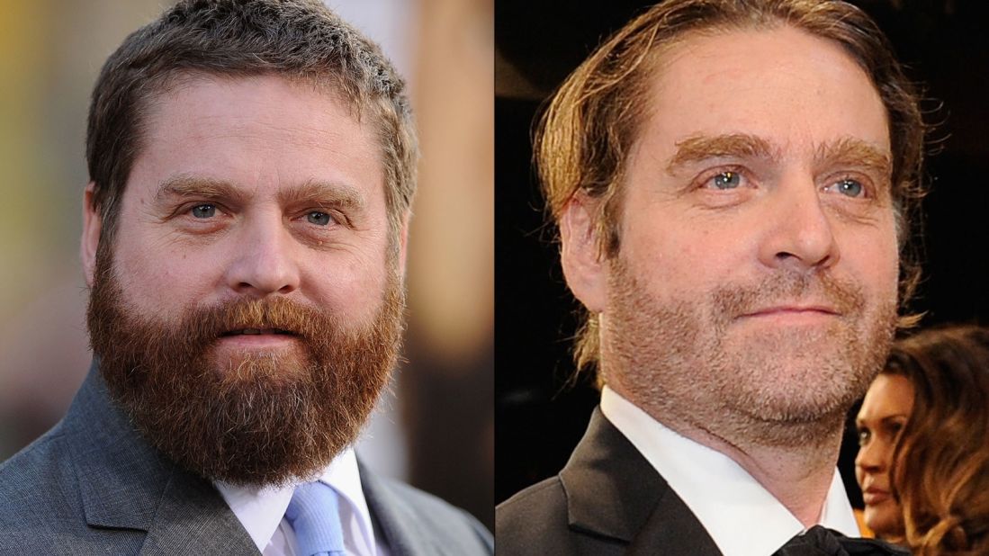 The transformation of Zach Galifianakis continued at the Screen Actors Guild Awards in January 2015, where the actor was barely recognizable from years past. What a difference some pounds and some facial hair can make. He first started slimming down in 2013, <a href="http://teamcoco.com/video/zach-galifianakis-drinking" target="_blank" target="_blank">when he decided to stop drinking. </a>