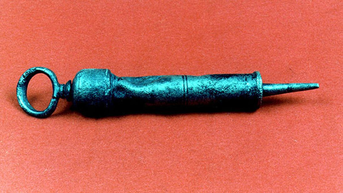 A urethral syringe was one of the findings aboard the Queen Anne's Revenge, the pirate Blackbeard's ship that was wrecked off North Carolina in 1718. It had traces of mercury, which was a popular treatment for syphilis at the time.