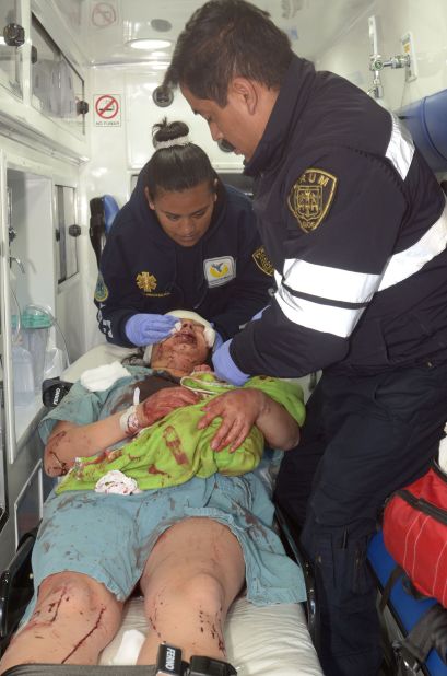 An injured woman is treated after the blast.