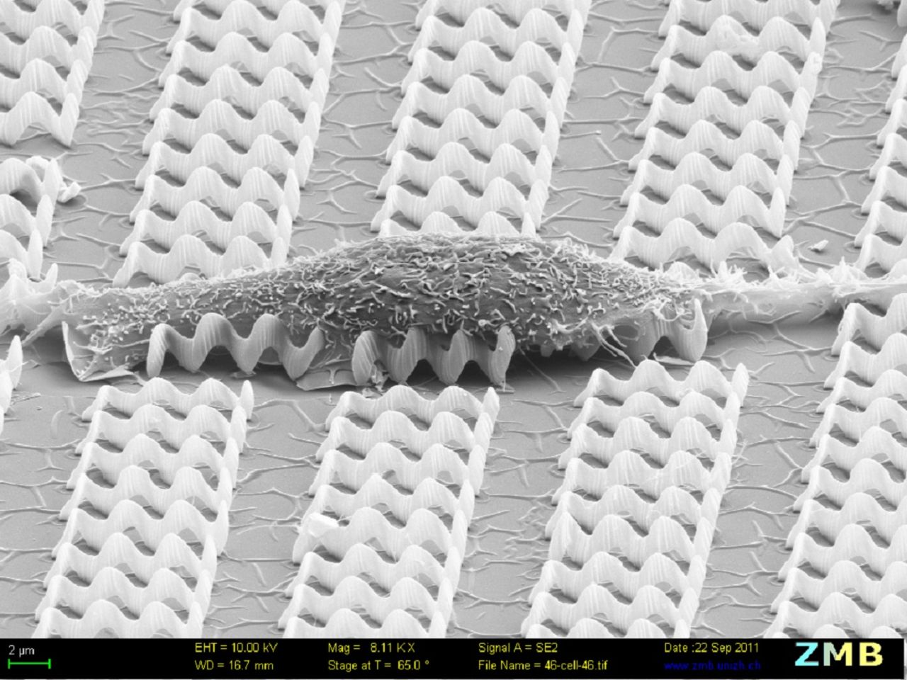 A muscle cell resting on a bed of nanobots.