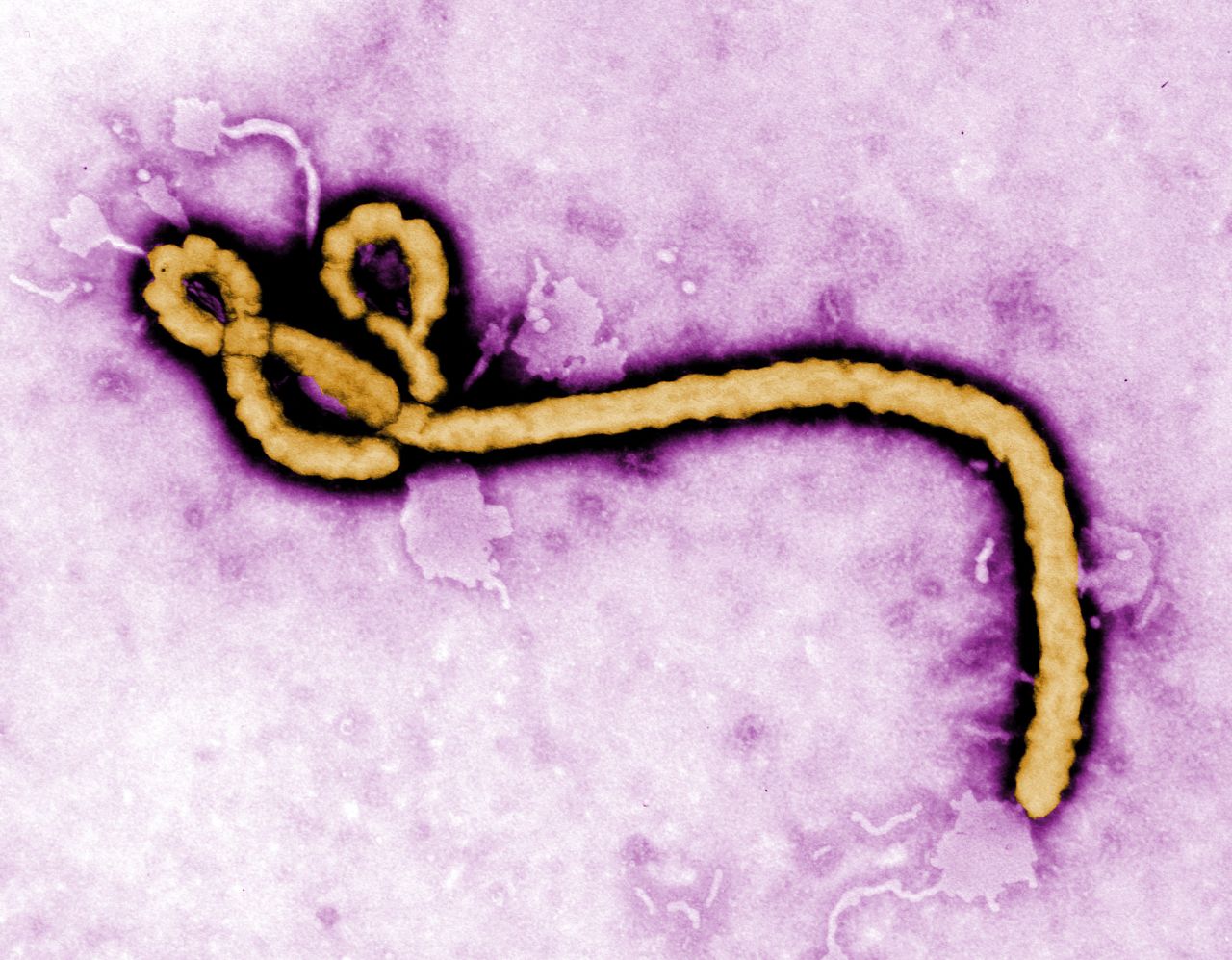 In 2014, the Ebola virus became internationally known due to an outbreak in West Africa, which killed more than 11,300 people. Pictured is a colorized transmission electron micrograph of an Ebola virus particle.