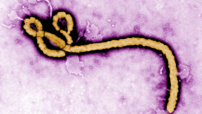 In 2014 the Ebola virus became internationally known due to an outbreak in West Africa which has infected more than 22,000 people to date. Depicted is a colorized transmission electron micrograph (TEM) of a Ebola virus particle.