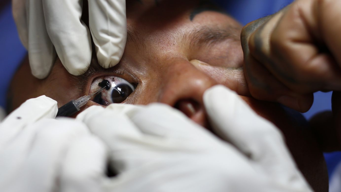 A man has his eye tattooed black Friday, January 30, at the International Tattoo Festival in Caracas, Venezuela.