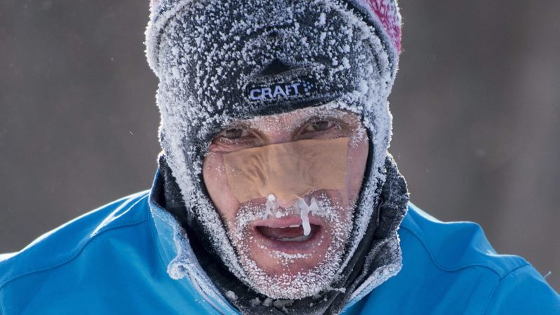 Icicles form on a competitor's nose during the Gatineau Loppet, a cross-country skiing event in Gatineau, Quebec, on Sunday, February 15.